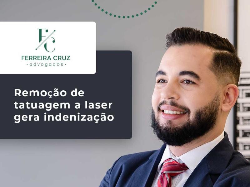 Remoção de Tatuagem a Laser Gera Indenização