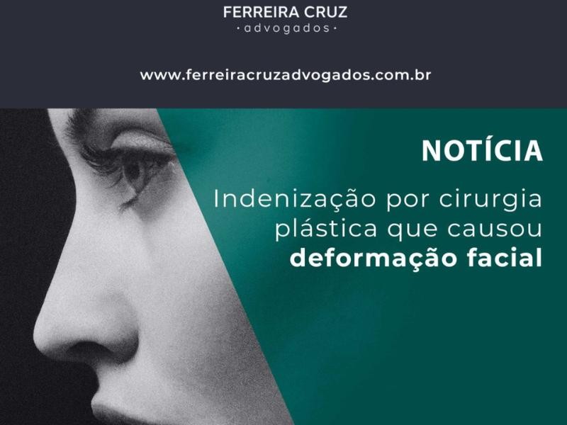 Indenização por Cirurgia Plástica que Causou Deformação Facial