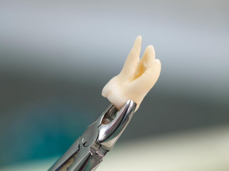 Erro Médico Extração de Dente